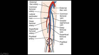 Lower Extremity Deep Venous Thrombosis DVT [upl. by Rinna]