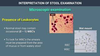 Interpretation of Stool Examination [upl. by Adrian752]