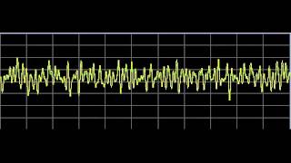 Brain Diseases  Rife Frequencies [upl. by Meensat391]