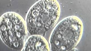 Ciliates moving detailed video [upl. by Notxam]