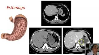 Anatomía Radiológica del Abdomen  Sistema Gastrointestinal [upl. by Missy]