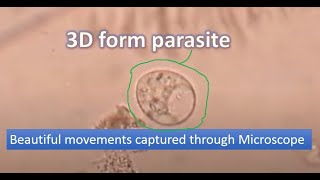 Motile trophozoite of Trichomonas under the Microscope [upl. by Settle490]