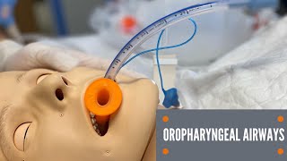 Oropharyngeal Airway Insertion [upl. by Jaella]