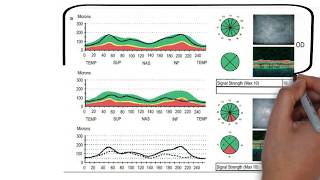 Optical Coherence Tomography  OCT  part1 [upl. by Neukam]