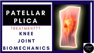 patellar plica syndrome treatment biomechanics explained physiotherapy tutorials [upl. by Leiba760]