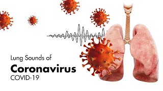 Sounds of Coronavirus COVID19  Lung Sounds [upl. by Atiner827]