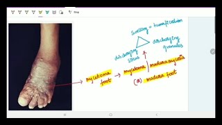 Subcutaneous Deep Mycoses  Microbiology  Image based discussion [upl. by Henryson]