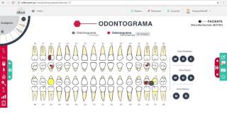 Como Funciona el Odontograma [upl. by Lladnar]