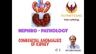 Congenital Hypothyroidism  causes  clinical features  screening  management  Endocrinology CH1 [upl. by Akim884]