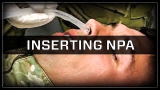 Inserting a Nasopharyngeal Airway NPA [upl. by Bushey]