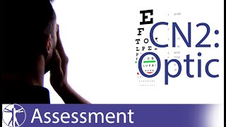 Cranial Nerve 2  Optic Nerve Assessment for Physiotherapists [upl. by Guttery]