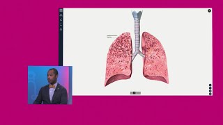 COPD vs Emphysema [upl. by Nyliak686]