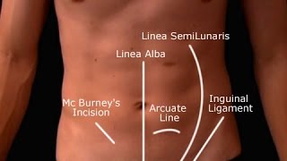 Appendicitis Ultrasound Lecture Version 01 [upl. by Edithe]