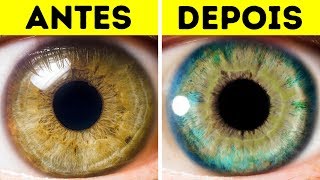 7 Coisas Que Podem Mudar A Cor Dos Seus Olhos [upl. by Ferdie]