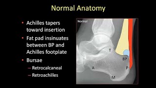 Emory MSK ELecture Series  Dr Hilary Umans [upl. by Ivetts]