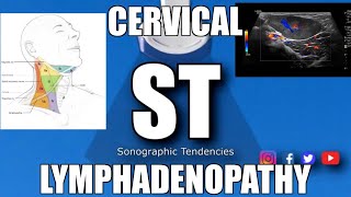 Sonoquickies  Cervical Lymphadenopathy [upl. by Sebastien]