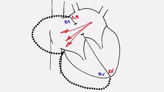 Congenital Anomalies of Kidney [upl. by Narot180]