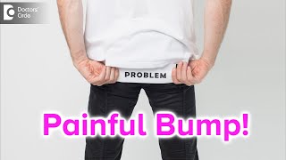 Painful bump on buttocks Causes Symptoms amp Treatment  Dr Rajdeep Mysore  Doctors Circle [upl. by Ysak]