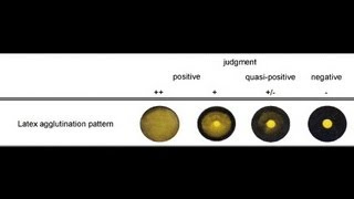 Latex Agglutination Test  Amrita University [upl. by Tiebold]