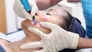 Microneedling Full Training Video [upl. by Nivel488]