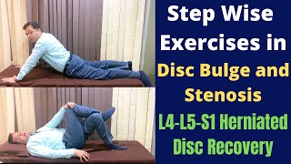 Disc Degeneration Disease DDD Treatment for Degenerative Disc Disease Lumbar Disc L4L5 L5S1 [upl. by Daven]