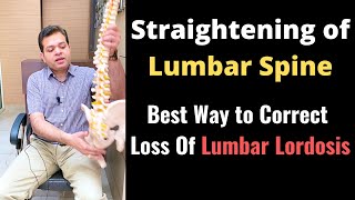 Straightening of Lumbar Spine Loss of Lumbar Lordosis Treatment How to Correct Lumbar Curvature [upl. by Dyche747]