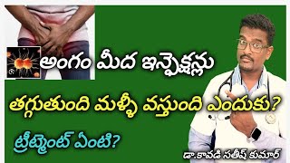 How to Cure Privite part infections In Telugu  Doctor Satheesh  Yes1TV Telugu [upl. by Areivax]