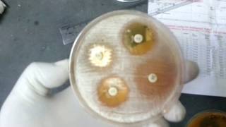 Antifungal sensitivity test  AFST of Yeast [upl. by Nolasba524]