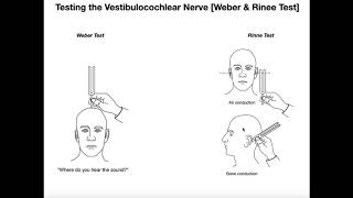 Interpreting the WeberRinne Tests EXPLAINED [upl. by Annahsohs]