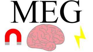 Magnetoencephalography measuring brain activity with magnetism [upl. by Herwin]