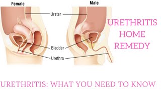 Urethritis What you need to know  urethritis home remedy [upl. by Jorin856]