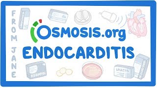 Clinicians Corner Endocarditis [upl. by Sylera]