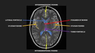 Introduction to MRI of the brain [upl. by Yttisahc]