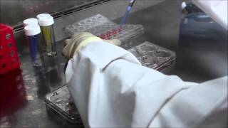 Virus plaque assay [upl. by Anoif]