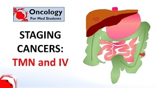 Systemic pathology 15  CNS 1 tumors of CNS  DRSAMEH GHAZY [upl. by Oetsira33]