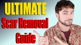 Scar Removal Products That Work  ULTIMATE Product Guide  Chris Gibson [upl. by Rist]