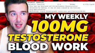 My Blood Work On 100 MG Testosterone Per Week With Accurate LCMSMS [upl. by Malka]