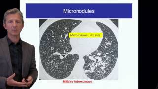 ECN PID cours 1 DFASM1 Diagnostic des PID Pr V Cottin Lyon [upl. by Berkman]