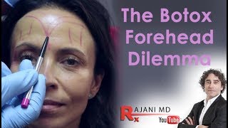 Botox Forehead Dilemma Explained Dr Rajani [upl. by Keefer]