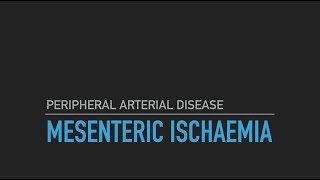 Mesenteric Ischaemia [upl. by Aydni504]