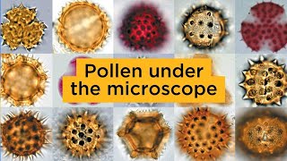 Pollen under the microscope [upl. by Orsola346]