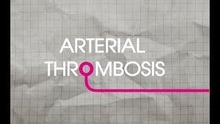 Arterial Thrombosis Explained [upl. by Moth]