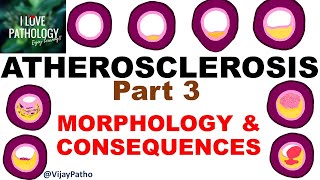 ATHEROSCLEROSIS Part 3  Morphology and consequences [upl. by Cope]