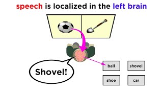 Brain Lateralization The Split Brain [upl. by Aleron]