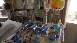 Bone Marrow Transplant Procedure and Recovery [upl. by Bakemeier]