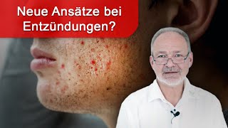 Entzündungen natürlich behandeln  neue Studien und Therapieansätze [upl. by Atsuj]