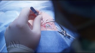 Open Heart Surgery What to Expect English CC [upl. by Ormiston]