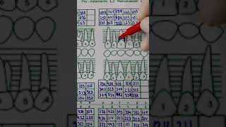 Periodontogramaclase de periodoncia [upl. by Otti644]