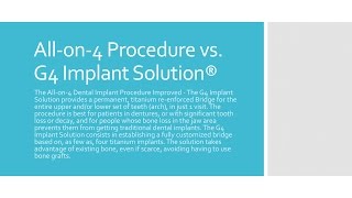 All on 4 Dental Implants vs The G4 Implant Solution [upl. by Glinys]