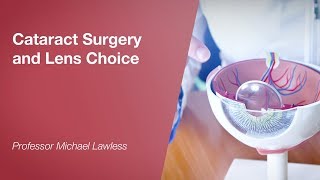 Cataract Surgery and Lens Choice [upl. by Anastasius]